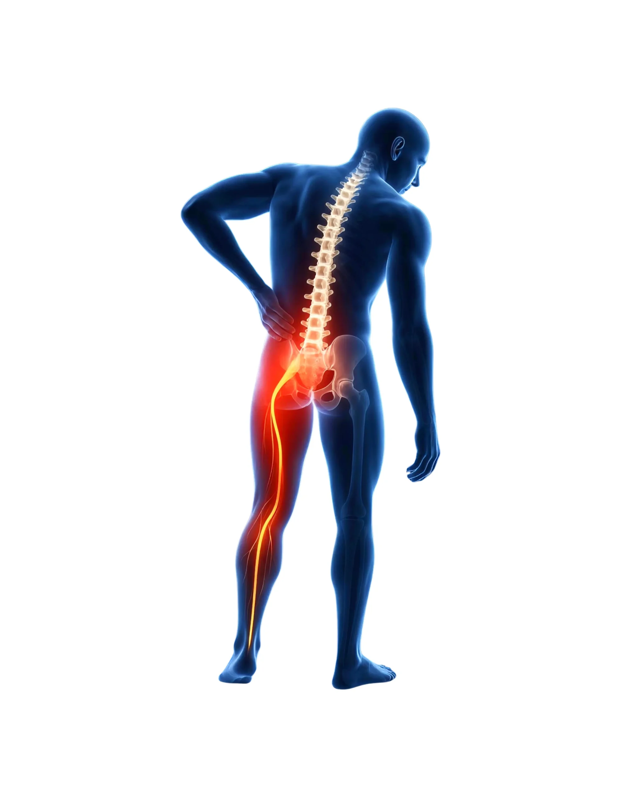 Sciatica treatment in St. Johns wood