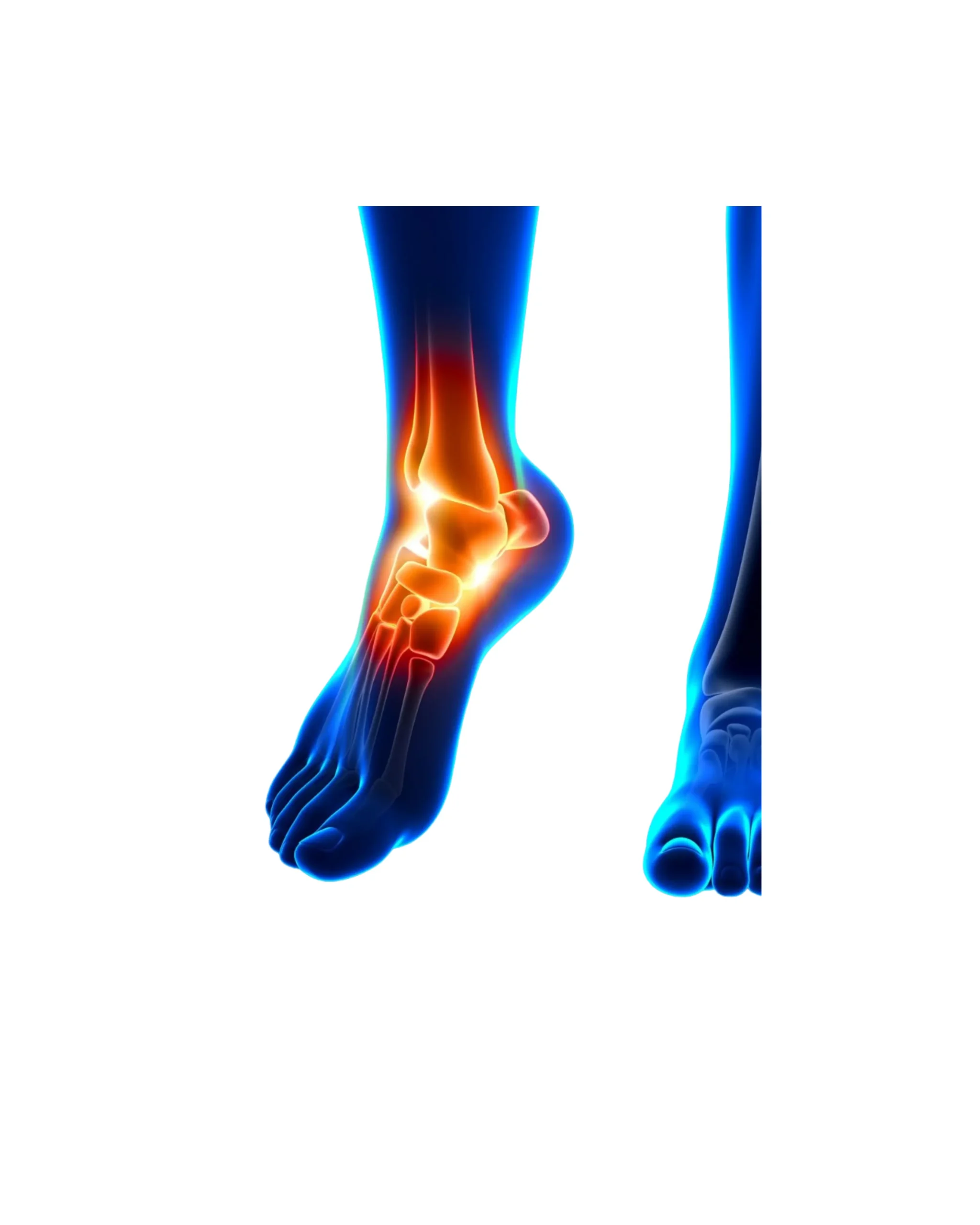 Ankle Pain physiotherapy in St. Johns wood