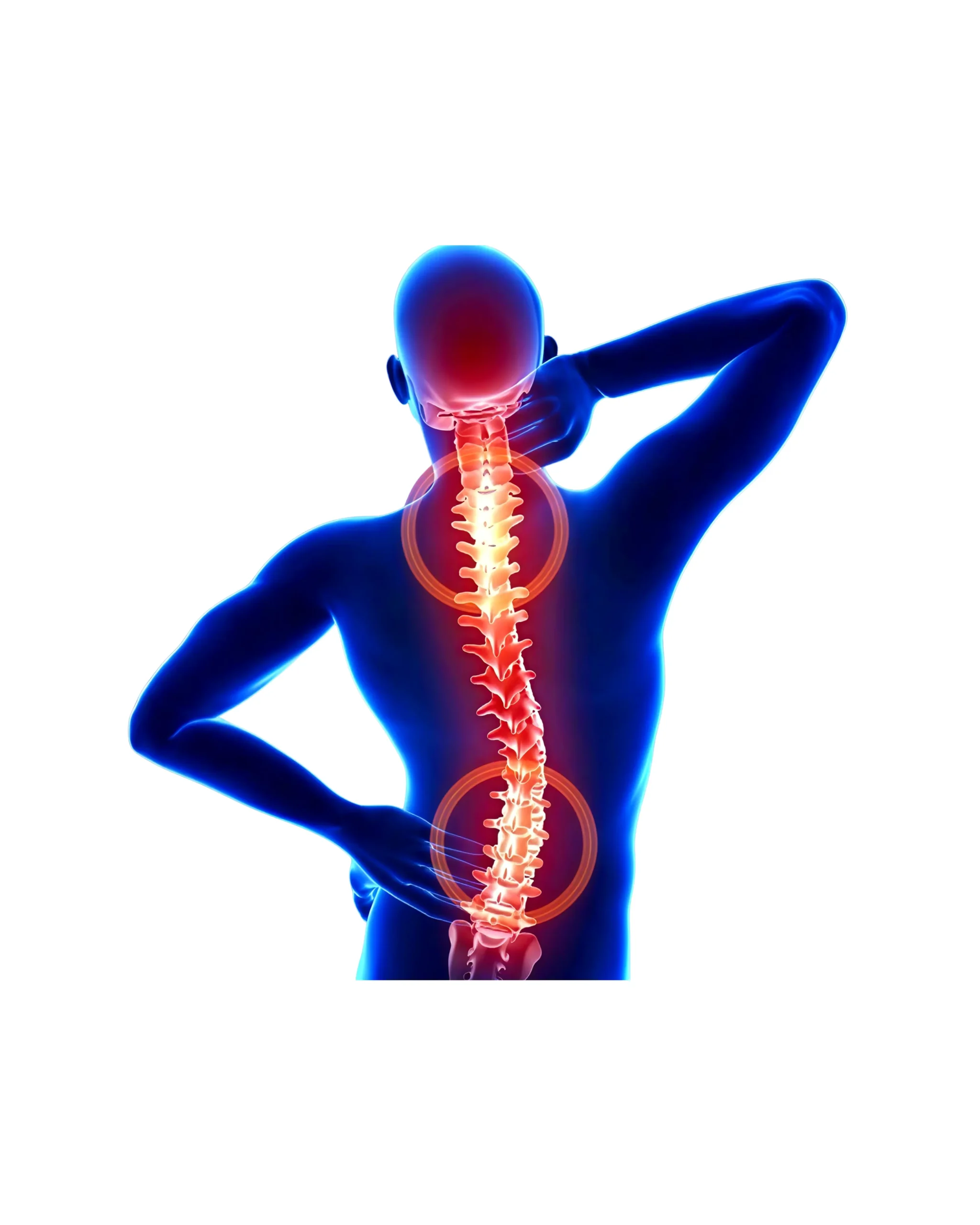 Back Pain physiotherapy in St. Johns wood