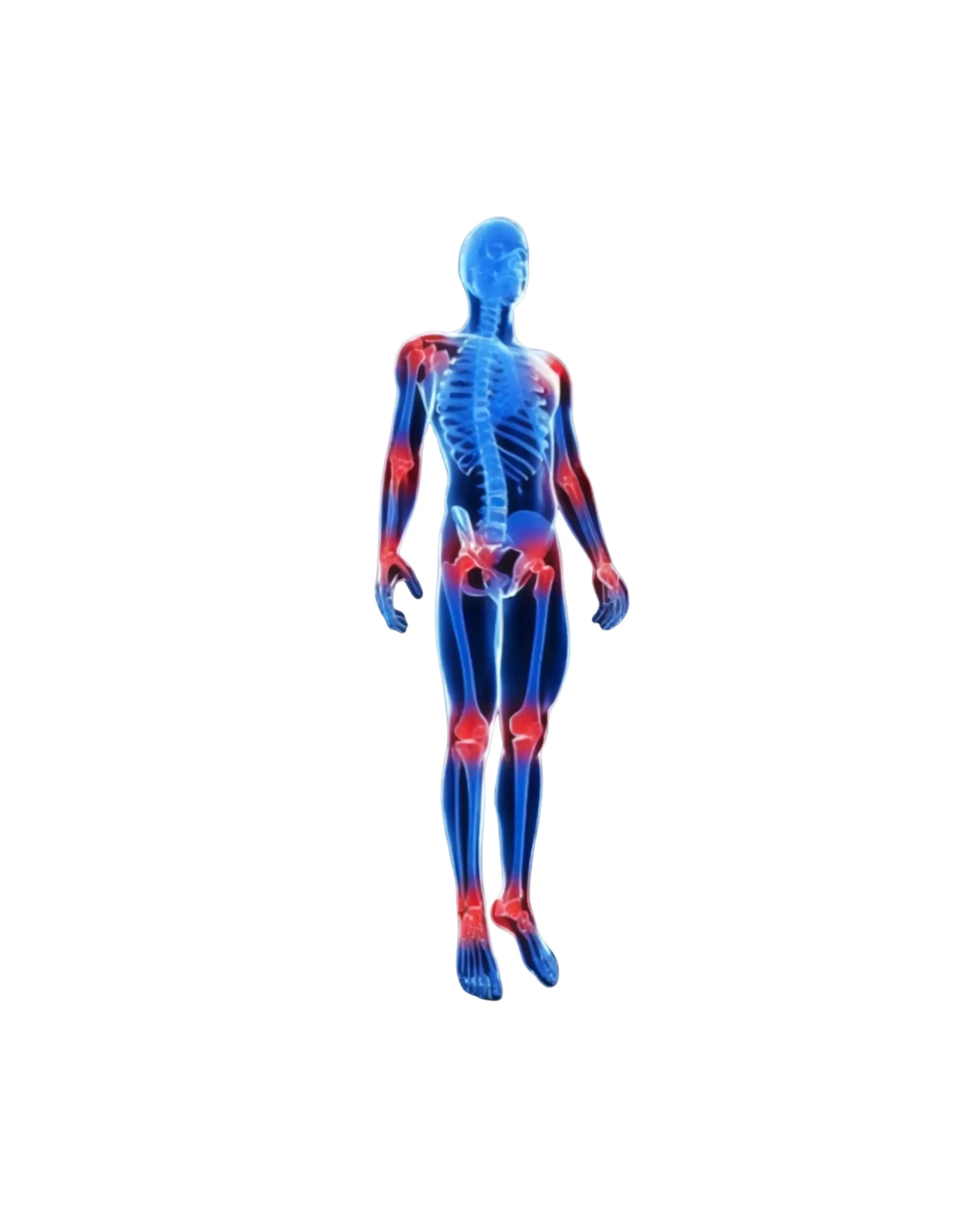 Joint Pain physiotherapy in St. Johns wood