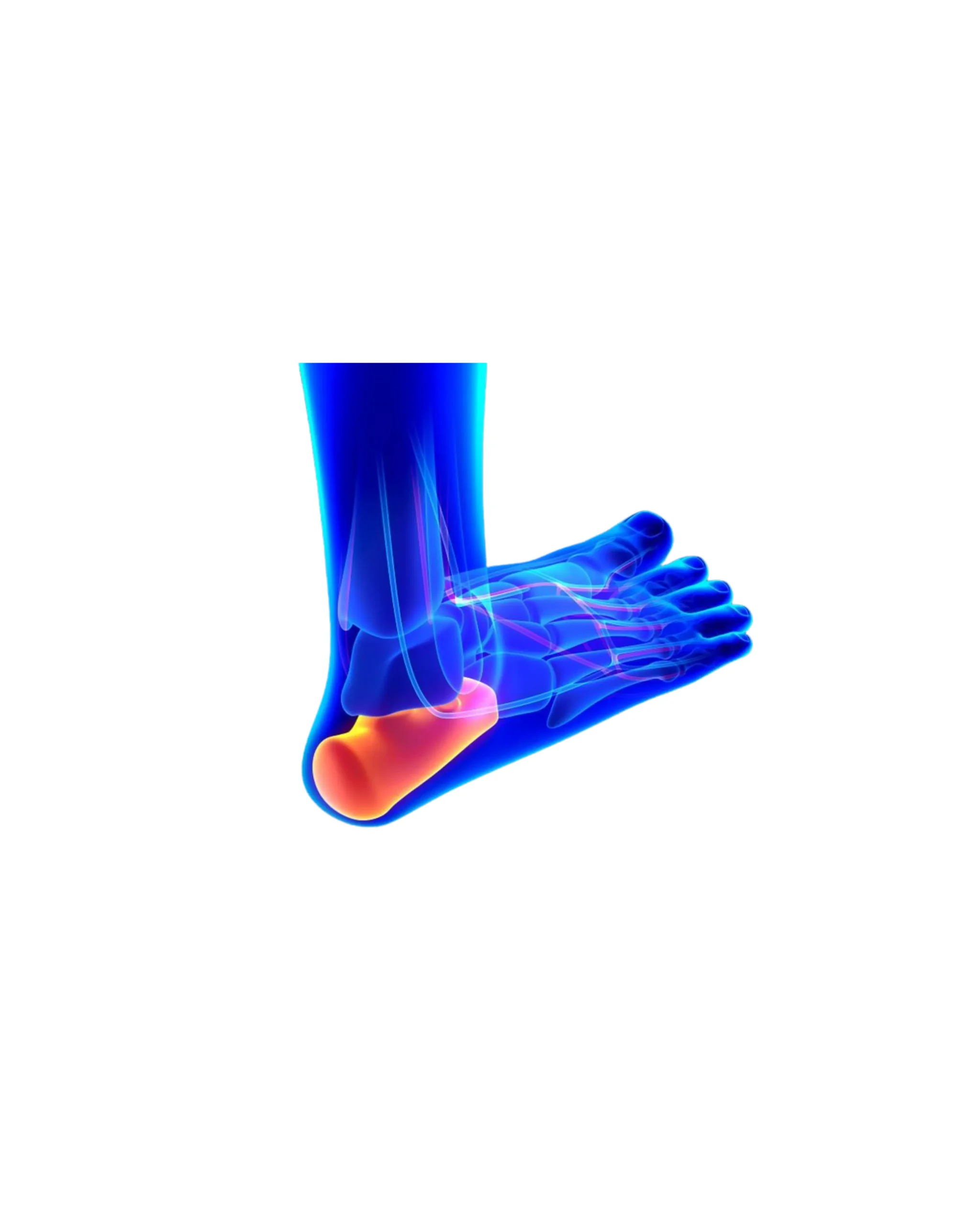 Heel Pain physiotherapy in St. Johns wood