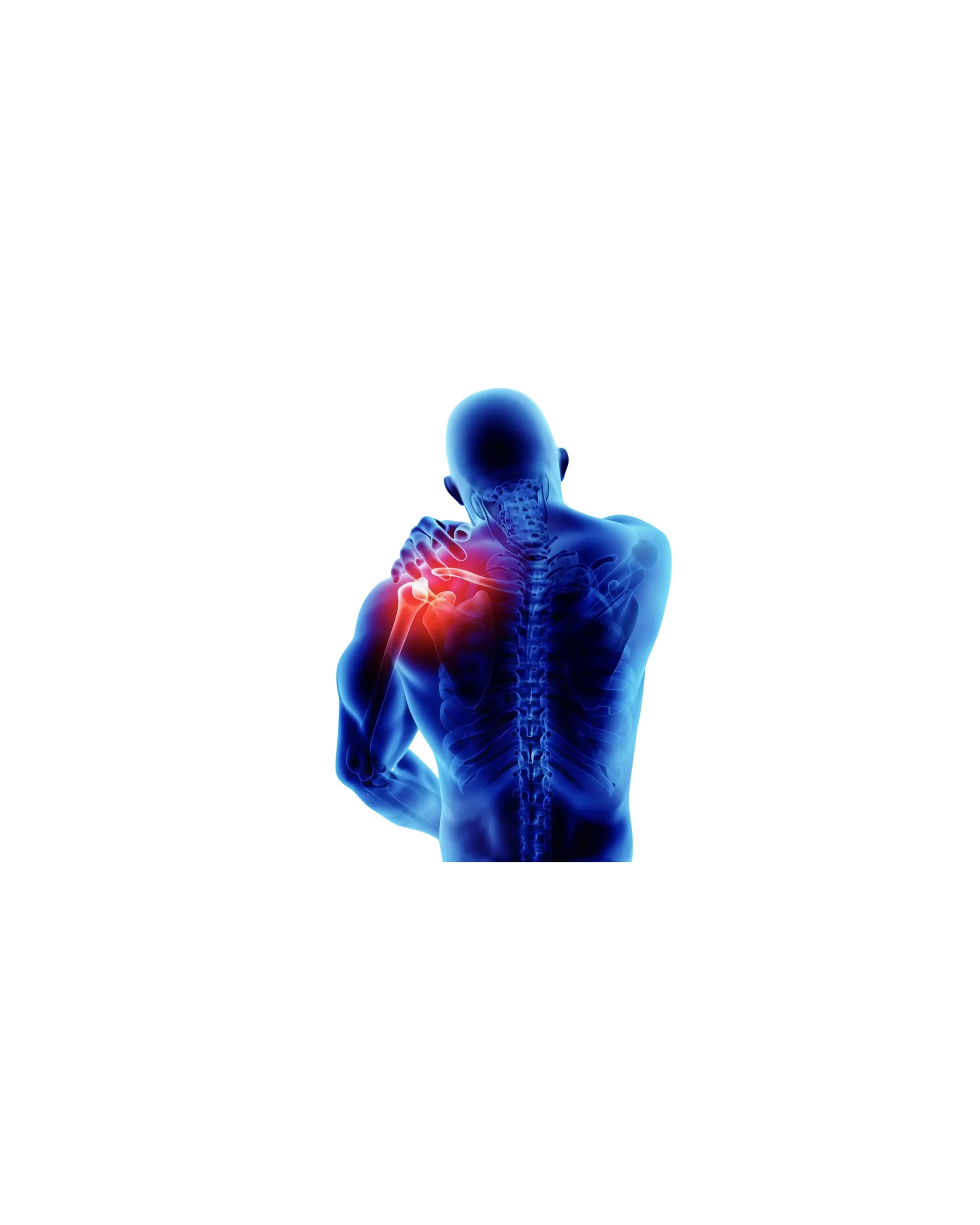 Shoulder Pain Physiotherapy in St. Johns wood